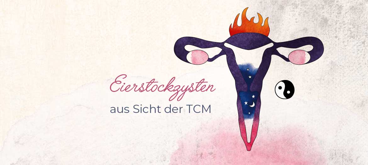 Zyste am rechten eierstock